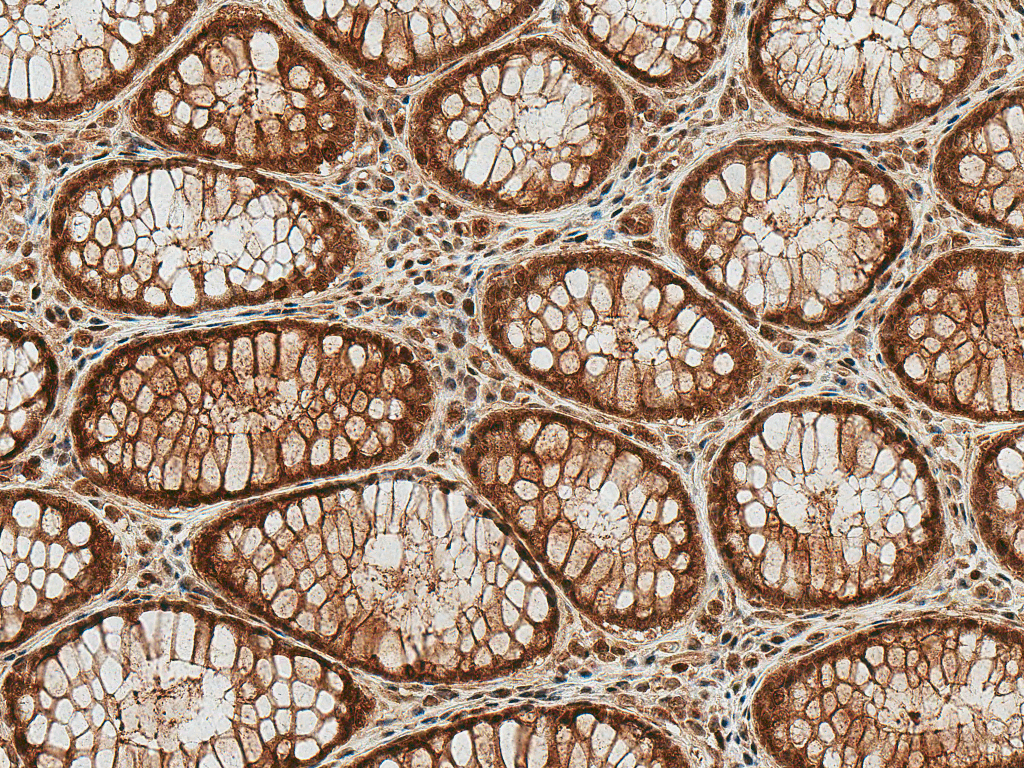 HSP70 / Heat Shock Protein 70 Antibody