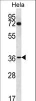 Polyclonal Rabbit anti-Human NUP35 / NUP53 Antibody (aa289-318, WB)