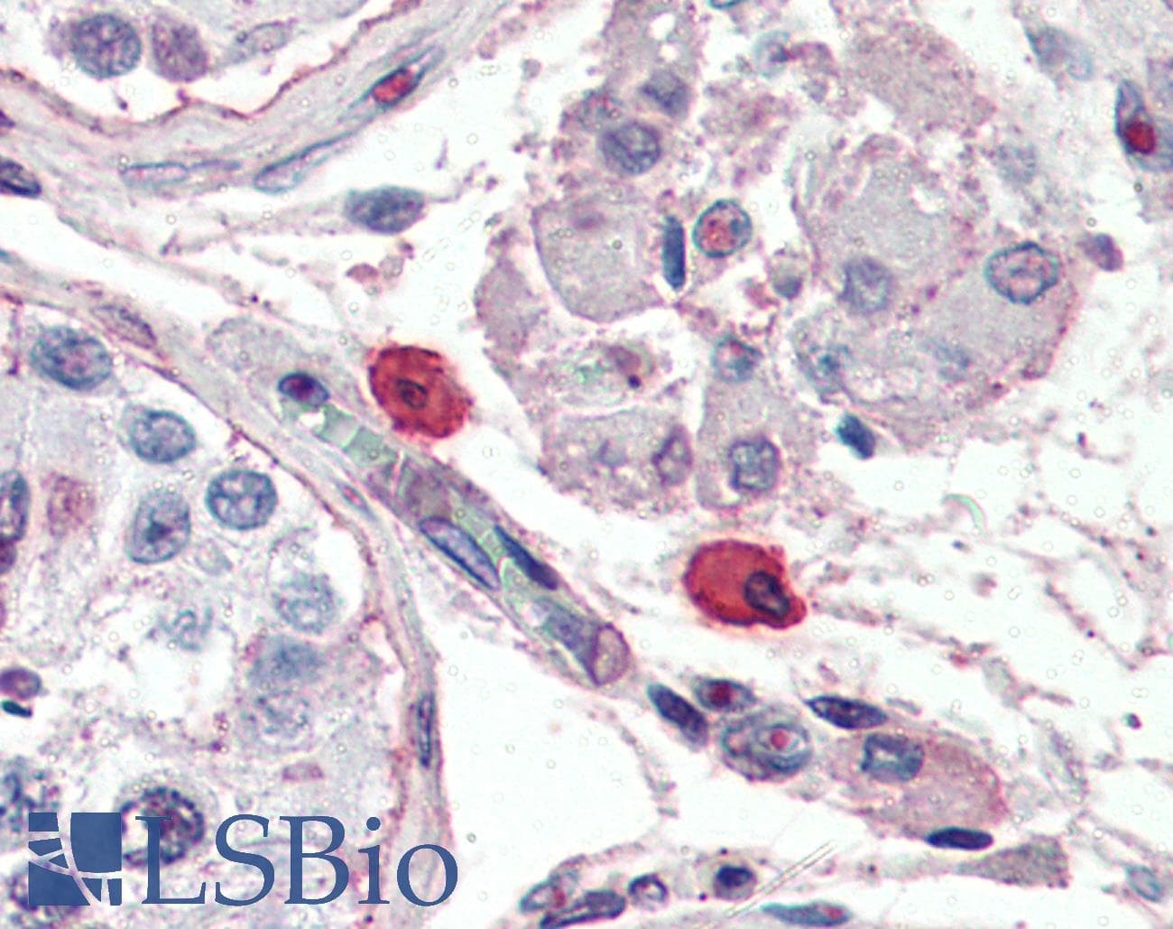 IHC-plus™ FceR1 / Fc Epsilon Receptor 1 Antibody (clone 9E1)
