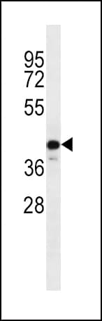 C9orf72 / ALSFTD Antibody (aa396-424)