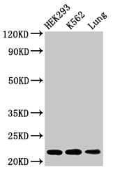 HIST1H1E Antibody