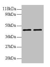 IHC-plus™ B4GALT3 Antibody (aa34-393)