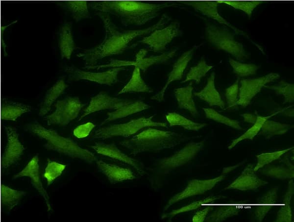 CDK9 Antibody (clone 2D7)