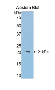 ACO1 / Aconitase Antibody (aa669-834)