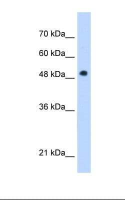 Polyclonal Rabbit anti-Human PNPLA3 / Adiponutrin Antibody (C-Terminus, IHC, WB)
