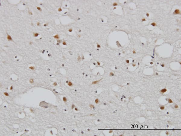 TBL1XR1 / TBLR1 Antibody (clone 3G7)