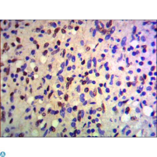 TRIM28 / KAP1 Antibody