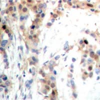 PDCD4 Antibody (N-Terminus)