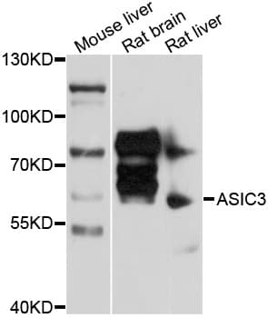 ACCN3 / ASIC3 Antibody