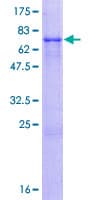 Human ZFP2 Protein (Recombinant GST)