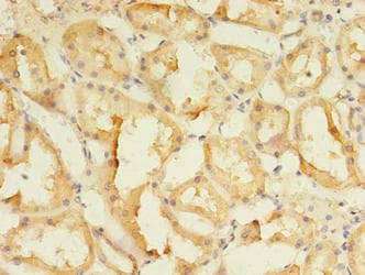 Polyclonal Rabbit anti-Human SPIRE2 Antibody (aa79-388, IHC)