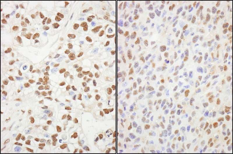 SUPT6H / SPT6 Antibody (aa1050-1100)