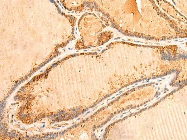 Polyclonal Rabbit anti-Human PPM1B Antibody (IHC)