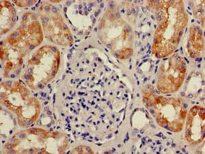 Polyclonal Rabbit anti-Human KIAA0467 / SZT2 Antibody (IHC)