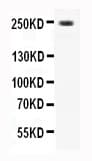CACNA1D / Cav1.3 Antibody (aa2146-2161)