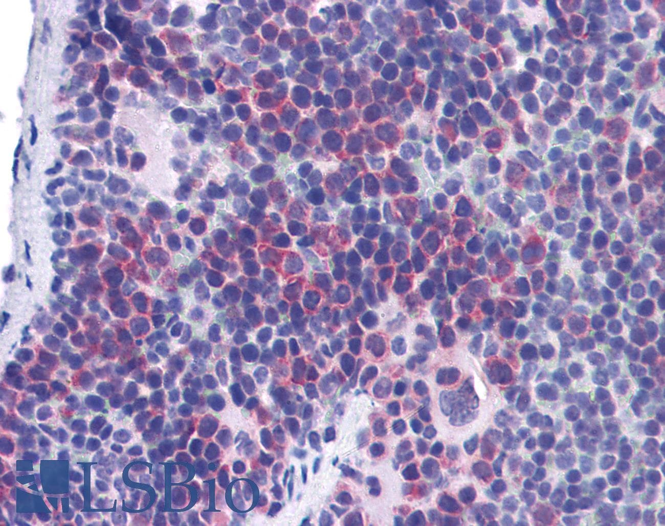 IHC-plus™ TIMD4 / TIM4 / TIM-4 Antibody
