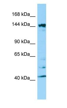 Polyclonal Rabbit anti-Human ITSN2 Antibody (aa1001-1050, WB)
