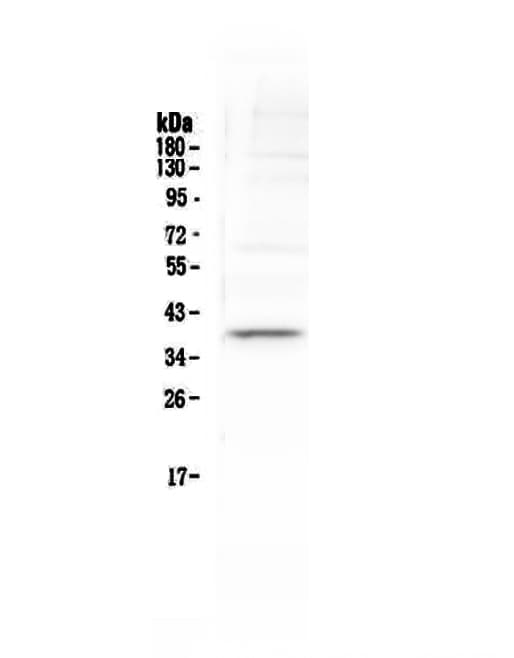 TAL1 Antibody
