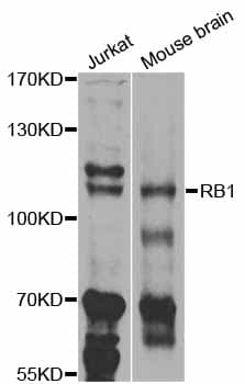 RB1 / Retinoblastoma / RB Antibody