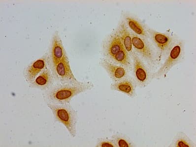 HIST1H2AI Antibody