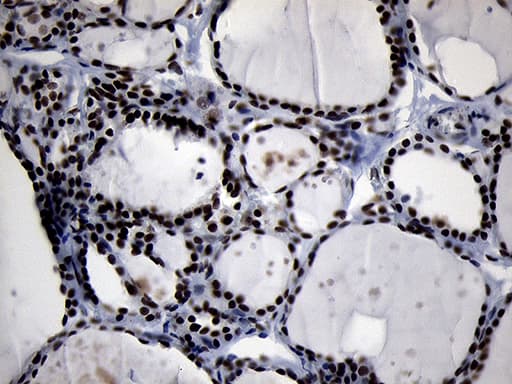 Monoclonal Mouse anti-Human ZHX2 / RAF Antibody (clone OTI2E11, aa595-837, IHC, WB)