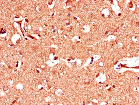 PINK1 Antibody