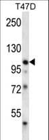 EPHB1 / EPH Receptor B1 Antibody (aa955-984)