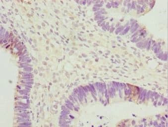 UGT2B10 Antibody