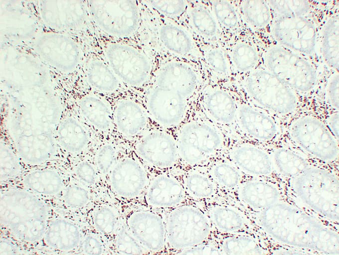 CDKN1B / p27 Kip1 Antibody (clone ABT-p27)