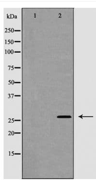 Polyclonal Rabbit anti-Human CASP1 / Caspase 1 Antibody (phospho-Ser376, WB)