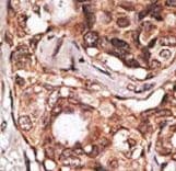 MAGEB2 Antibody (aa4-33)
