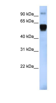 Polyclonal Rabbit anti-Human TRIM10 Antibody (aa396-445, WB)