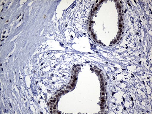 SDCCAG1 / NEMF Antibody (aa869-1076, clone OTI7E10)