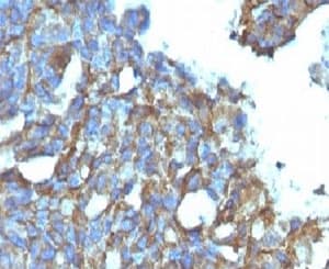 CD99 Antibody (clone CDLA99)