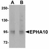 Polyclonal Rabbit anti-Human EPHA10 / EPH Receptor A10 Antibody (WB)