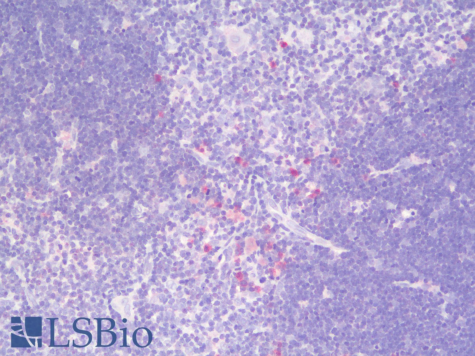 PathPlus™ ITGAX / CD11c Antibody
