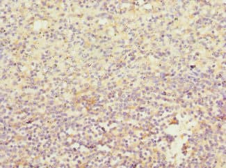 IL21 Receptor Antibody
