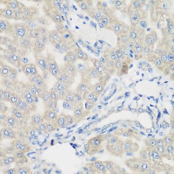 Polyclonal Rabbit anti-Human PYCR1 Antibody (IHC, WB)