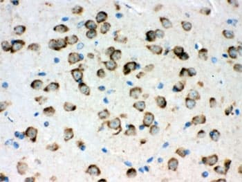 HSPA5 / GRP78 / BiP Antibody