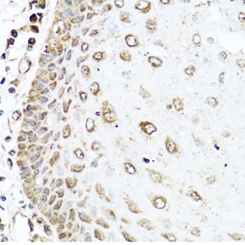 RAC2 Antibody