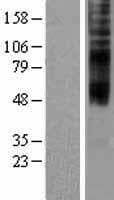 Human TMEM144 Protein (Over-Expression Lysate Myc-DDK (Flag))