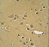 Polyclonal Rabbit anti-Human AMY2B Antibody (aa74-100, IHC, IF, WB)