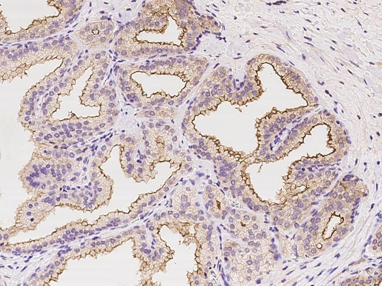 TMPRSS2 / Epitheliasin Antibody