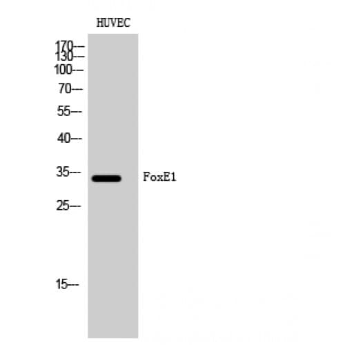 FOXE2 / FOXE1 Antibody (10-90 aa, N-terminal)