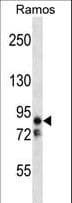 MARK2 Antibody (aa600-630)