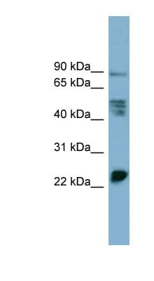 MPZL1 Antibody (aa107-156)