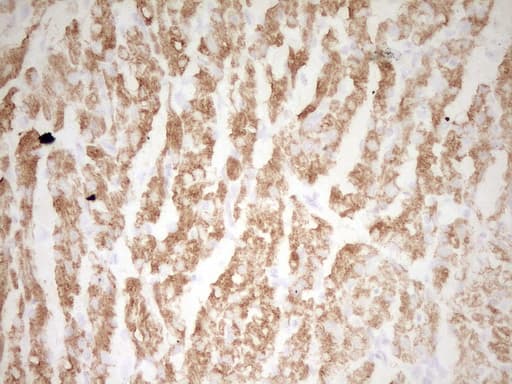 TNNI3 / Cardiac Troponin I Antibody (clone OTI14A2)