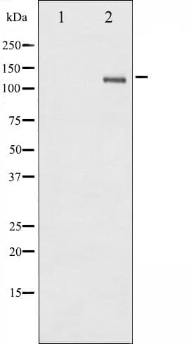 FAK / Focal Adhesion Kinase Antibody (phospho-Tyr861)