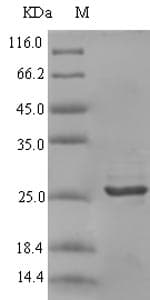 Rabbit CXCL9 / MIG Protein (Recombinant 6His-SUMO, N-terminus)