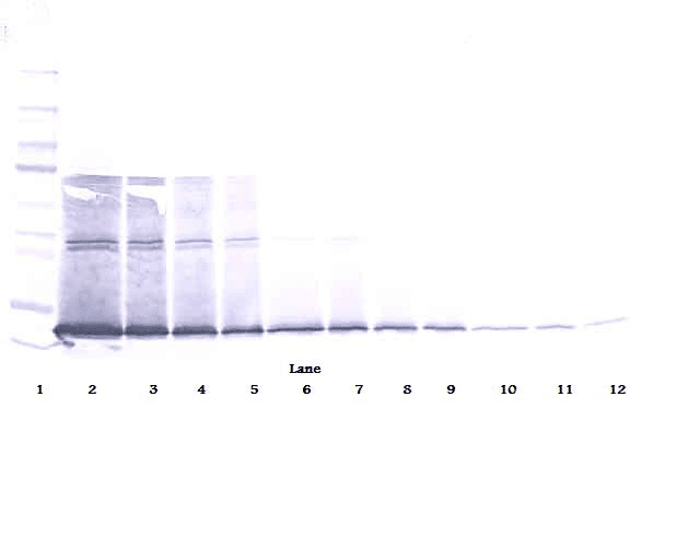 Polyclonal Rabbit anti-Mouse IL5 Antibody (WB)